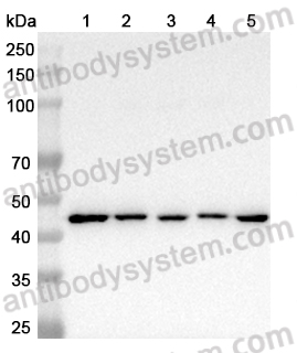 Anti-ACTB/β-actin/Beta Actin Antibody (SAA0339)